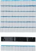 BGS keréksúly, öntapadós 12 x 5 g 50 darabos