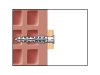Műanyag dübel MFR 10-60 SB TX (4 db/cs)